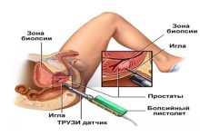 Photo of Что такое мужское УЗИ и зачем оно необходимо