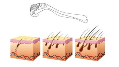 Photo of Массаж для стимуляции роста волос